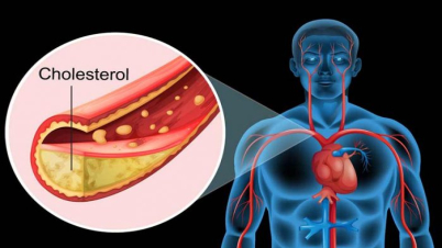 শীতে কোলেস্টেরলের মাত্রা বাড়ে দ্বিগুণ, সুস্থ থাকতে যা করবেন