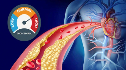 যেসব খাবার কোলেস্টেরল কমায়